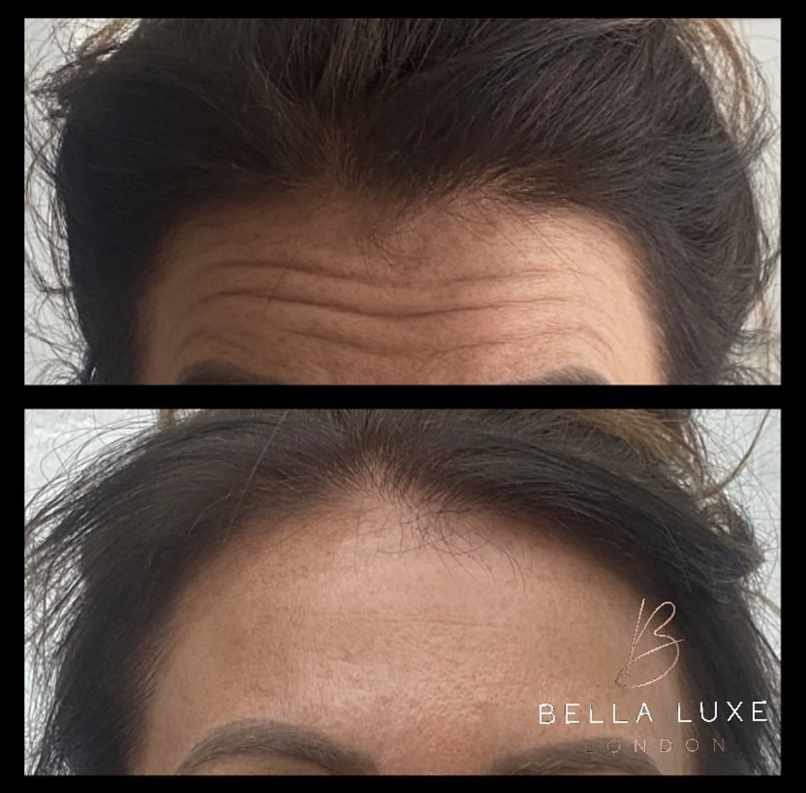 Aesthetics Clinic in Kentish Town | Bella Luxe LDN gallery image 2